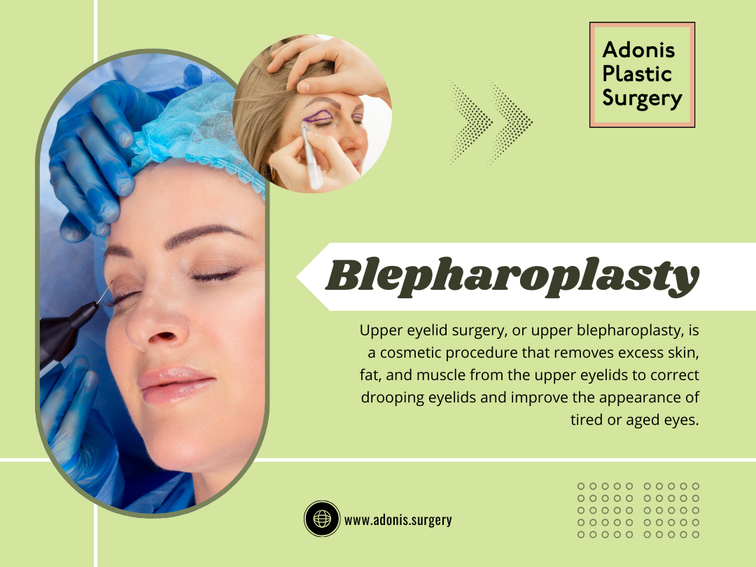 Blepharoplasty