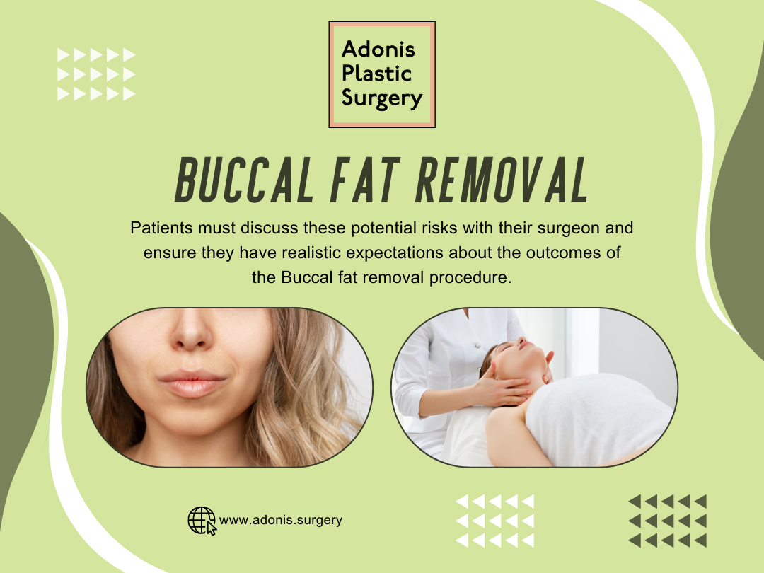 Buccal Fat Removal