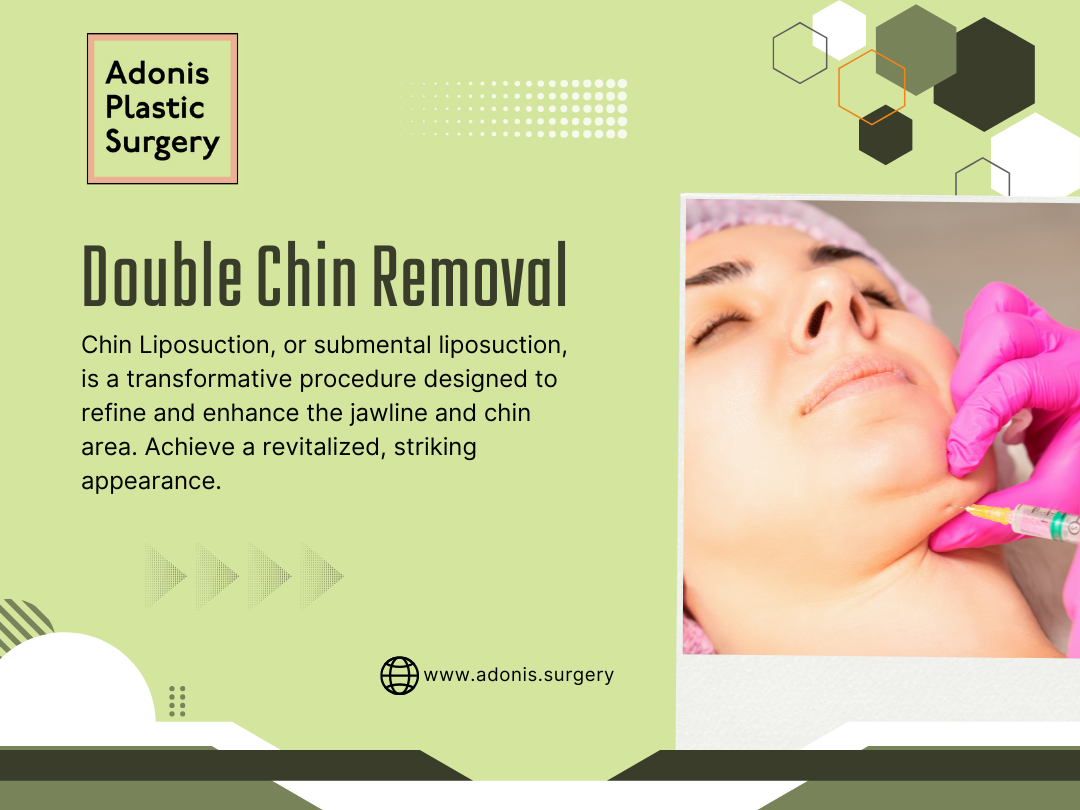 Double Chin Removal