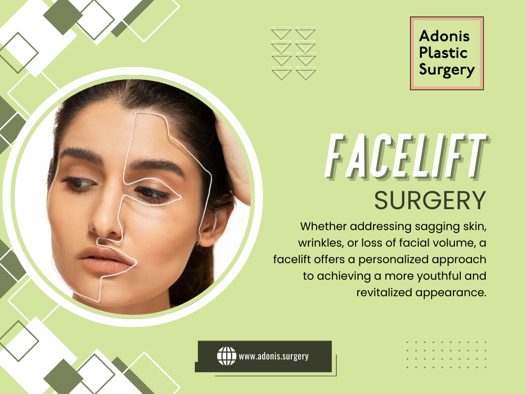 Face Lift Surgery