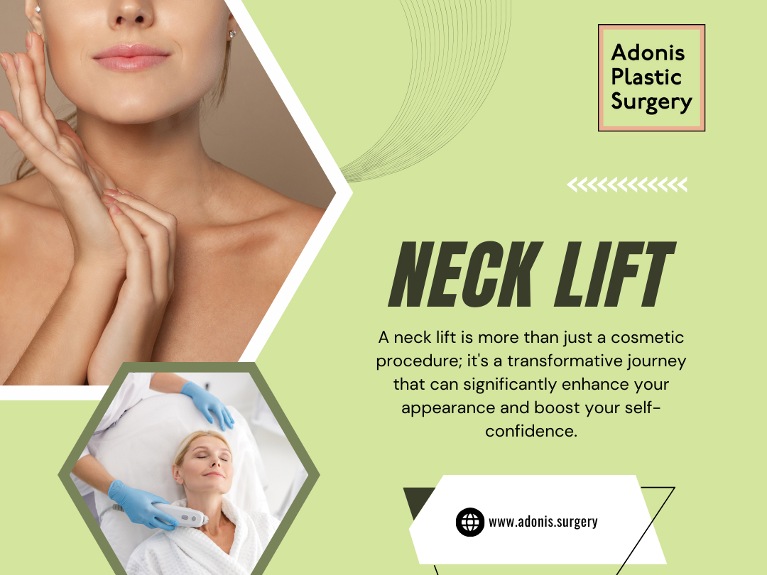 Neck Lift