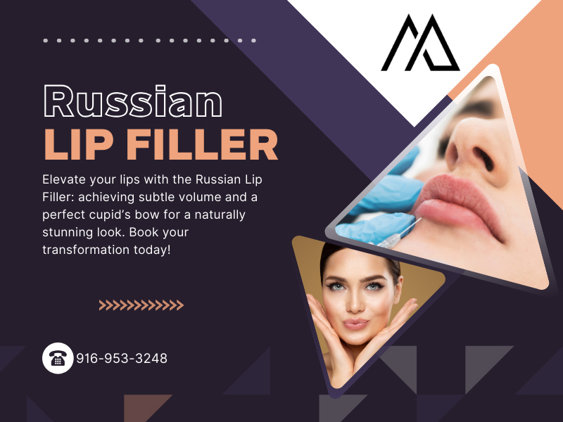 Russian Lip Filler