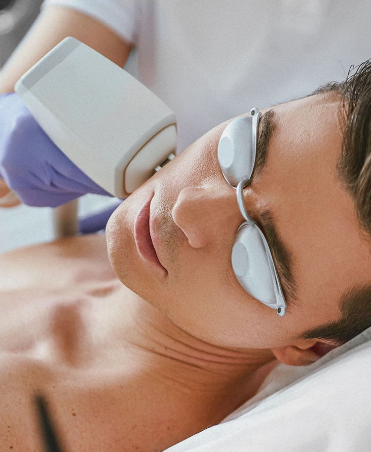 ipl hair removal-distill laser clinic-north york