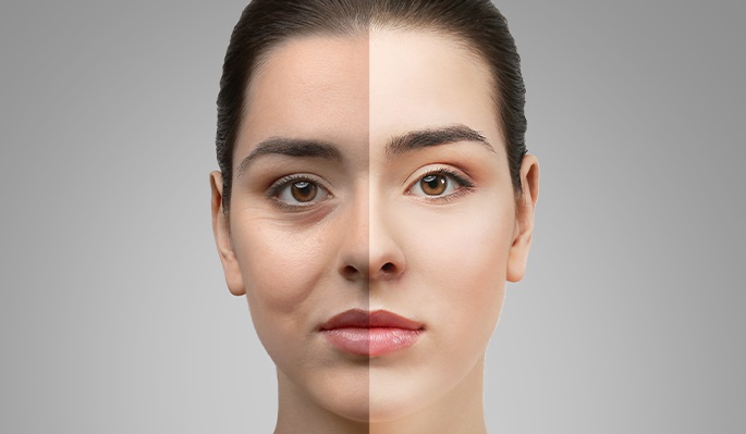 non surgical facial contouring-distill laser clinic-north york